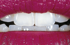 sdl image